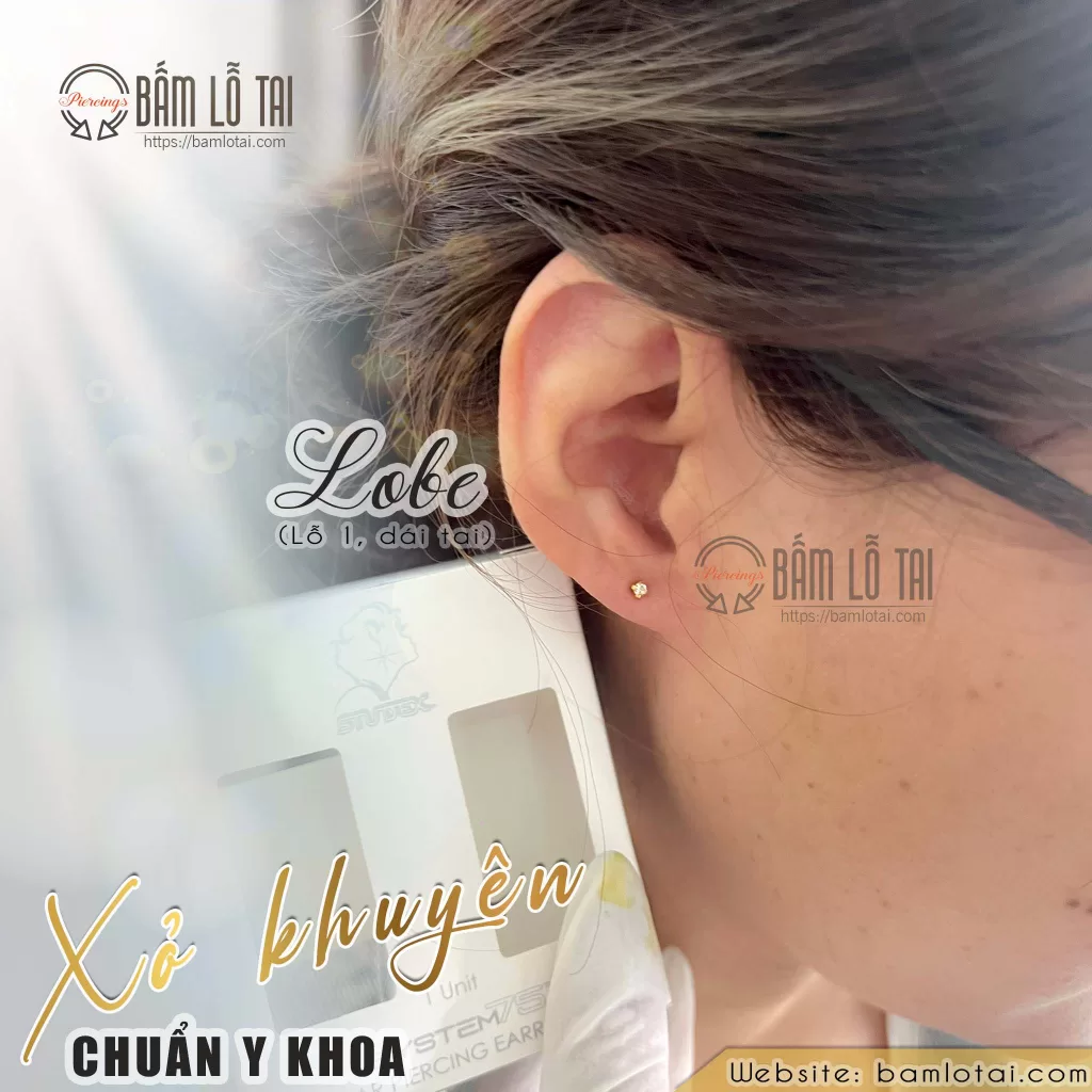 Dịch vụ Xỏ khuyên (bấm lỗ tai) Lobe 1, 2, 3 Chuẩn Y Khoa tại "Xỏ Khuyên Chuẩn Y Khoa" 5 230414 bam lo tai co dau khong
