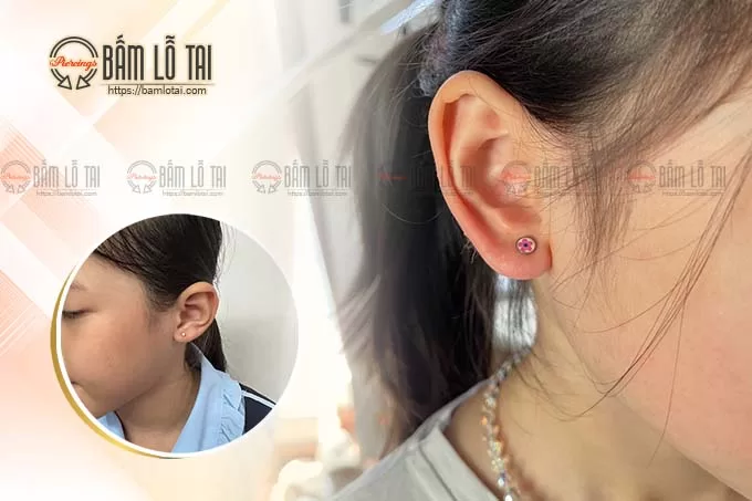 Dịch vụ Xỏ khuyên (bấm lỗ tai) Lobe 1, 2, 3 Chuẩn Y Khoa tại "Xỏ Khuyên Chuẩn Y Khoa" 2 bam lo tai khong dau tre em jpg