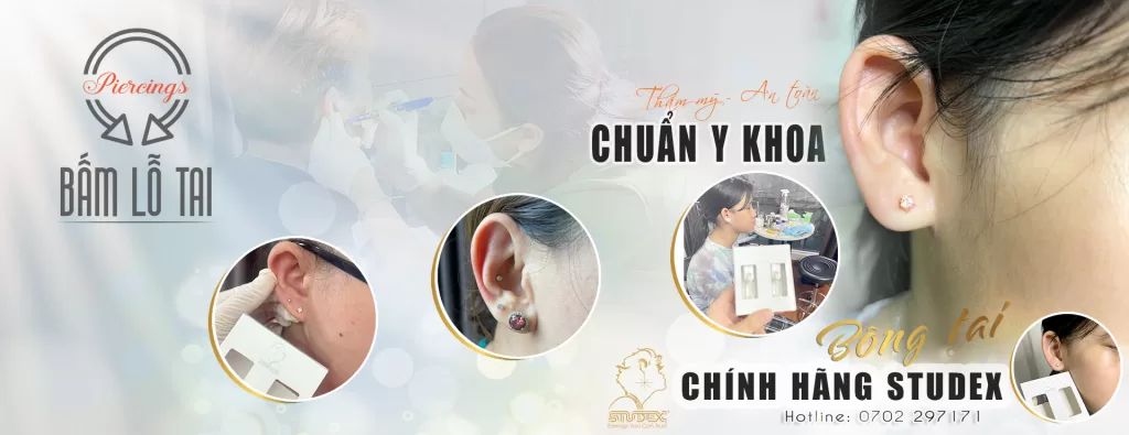 xo khuyen tai o dau hcm