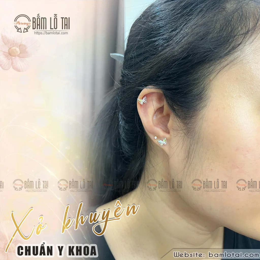 Xỏ khuyên lỗ sụn vành tai – Xu hướng làm đẹp an toàn và đẳng cấp tại Xỏ khuyên chuẩn Y khoa 3 bam lo tai 2024 18