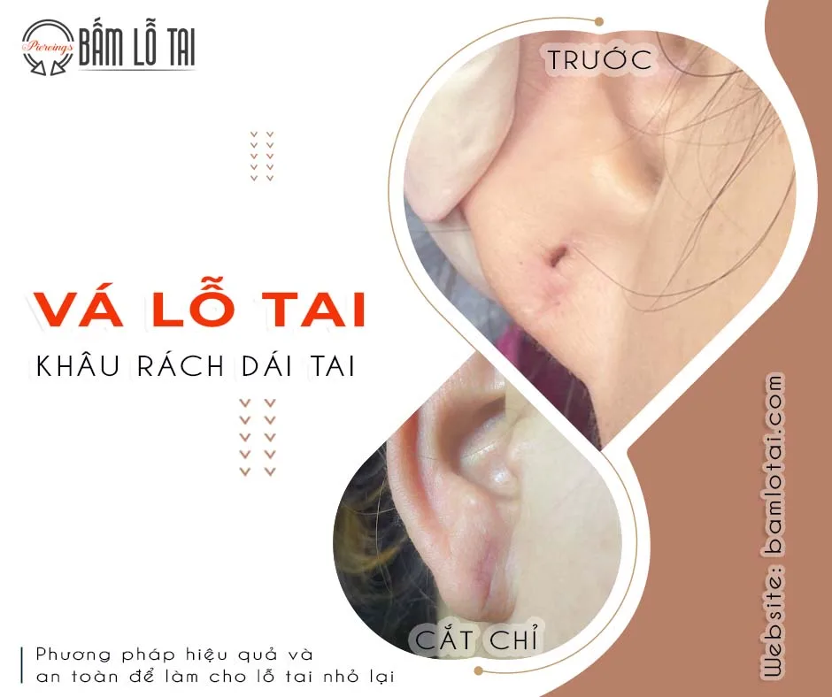 VA LO TAI KHAU RACH LO TAI jpg