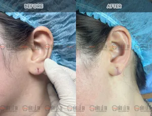 va lo tai tham my chuan y khoa